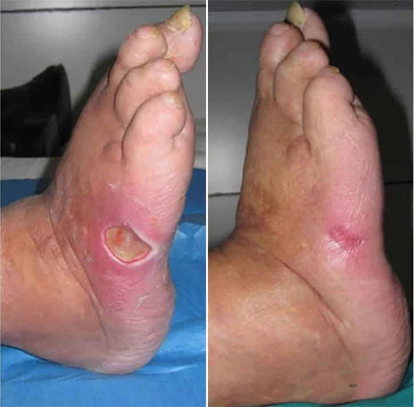 Risarisa® BERBERINE Nano Patch Solution A comprehensive 24 2897626d5e4e4715a4136ccdb61814c2