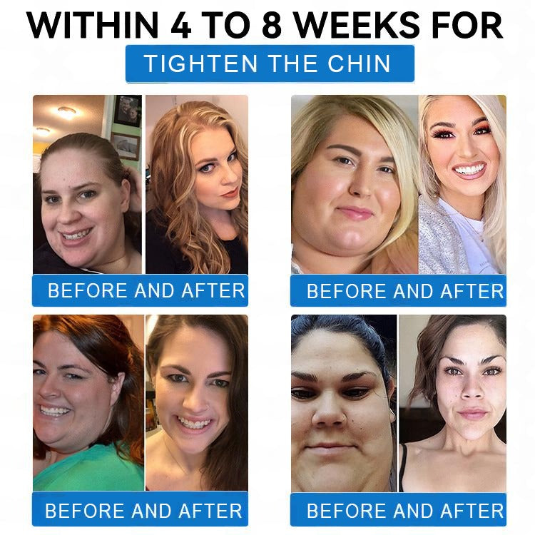 【See results in 7 days】📢SMGT-GLP-1 𝐓𝐢𝐫𝐳𝐞𝐩𝐚𝐭𝐢𝐝𝐞 & 𝐂𝐨𝐥𝐥𝐚𝐠𝐞𝐧 𝐍𝐚𝐧𝐨 𝐌𝐢𝐜𝐫𝐨𝐧𝐞𝐞𝐝𝐥𝐞 𝐏𝐚𝐭𝐜𝐡