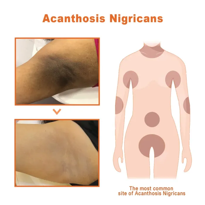 🌟Pigment Body Potion🌟 - Discoloration Correcting Serum