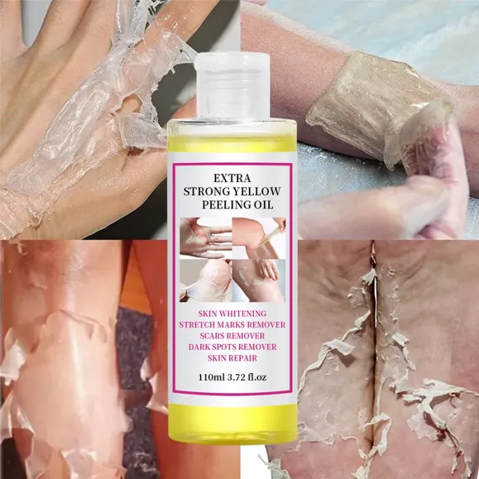 Extra Strong Yellow Peeling Brightening Oil – Gentle Body Hyperpigmentation Treatment 🧡