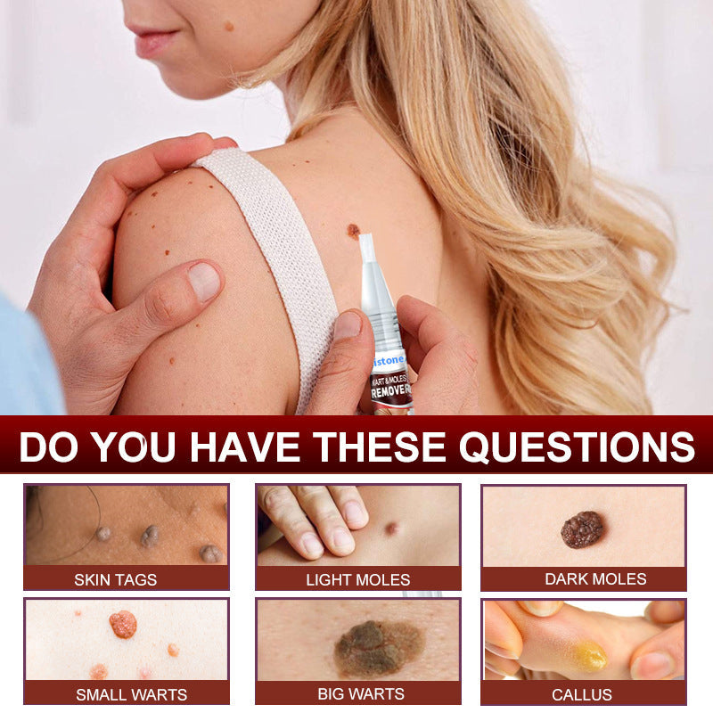 Buy 1 Get 1 Free - Safe, Painless and Fast Skin Tags Removal