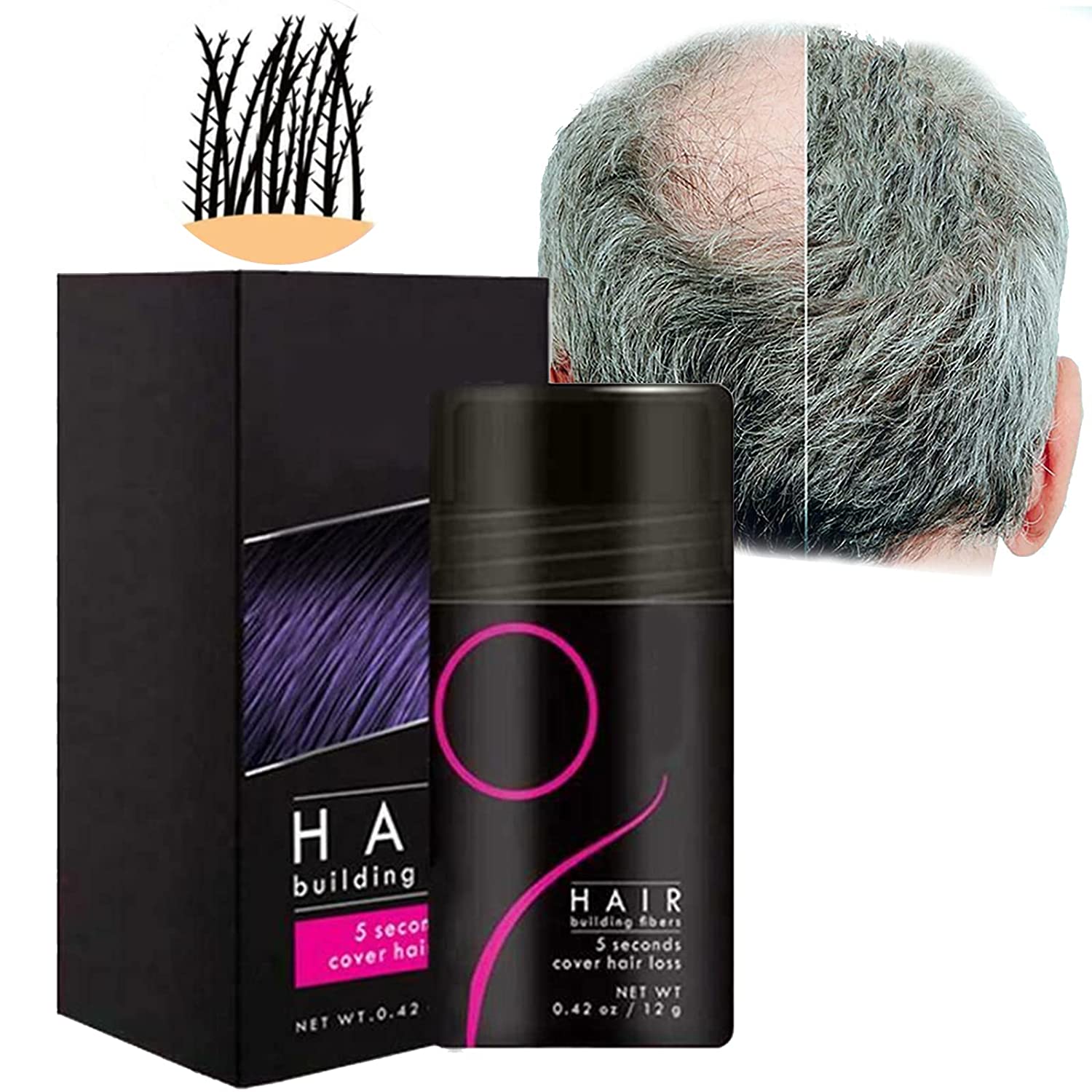 49% Off - Fluffup secret hair fiber powder-Effective hair supplement