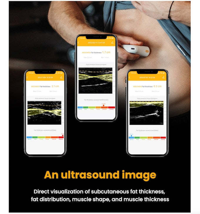 Body Fat Scanner Portable Ultrasound Measurement with Smart App, Postpartum Use is also Very Safe-Trainnox