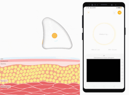 Body Fat Scanner Portable Ultrasound Measurement with Smart App, Postpartum Use is also Very Safe-Trainnox