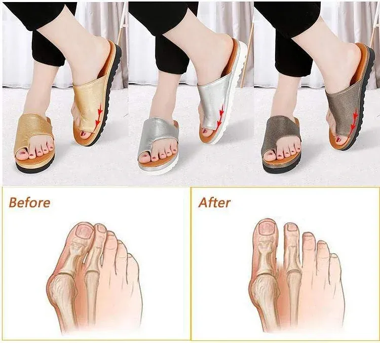 Orthopedic Bunion Corrector Sandals