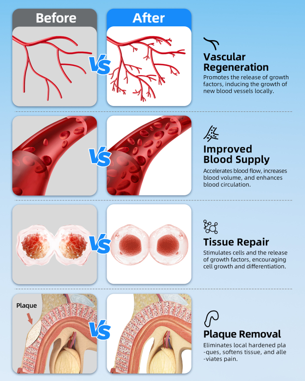 PerVita Medical Focused Shock Wave Therapy Machine PSP35