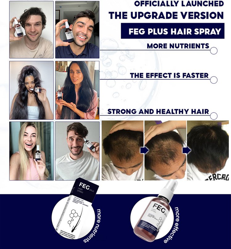 FEG Hair Growth Spray Sprzedaż bezpośrednia od producenta, gwarancja autentyczności!