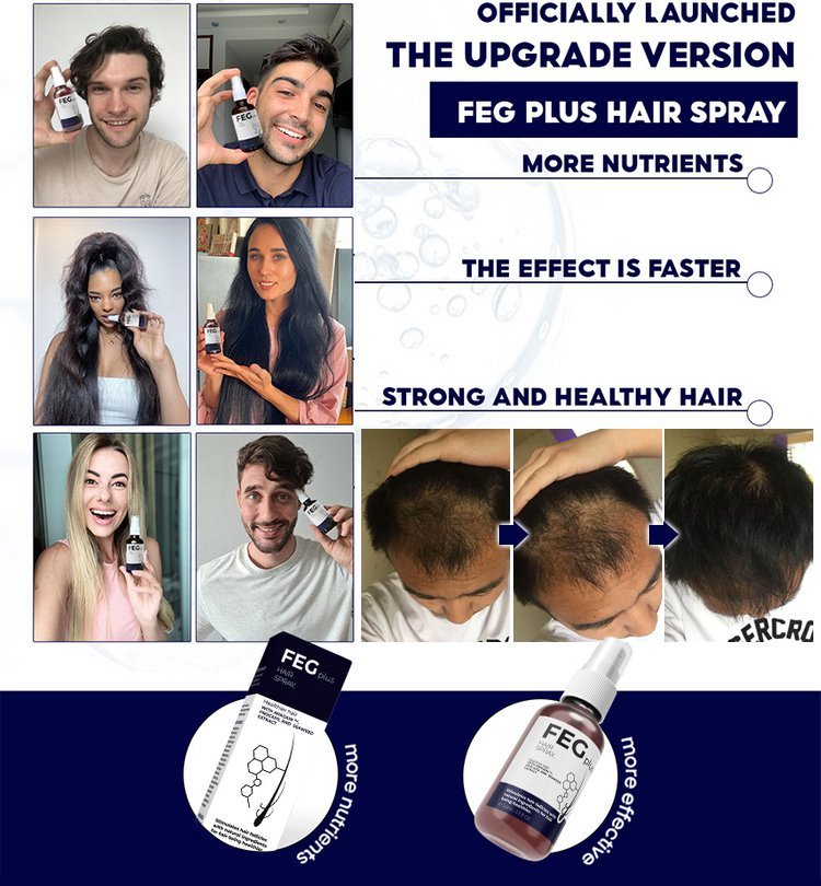 FEG Hair Growth Spray Sprzedaż bezpośrednia od producenta, gwarancja autentyczności!