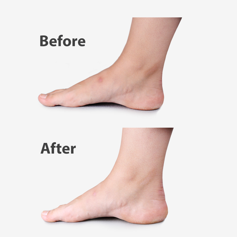 ScarGone Scar Management Massager Set  10