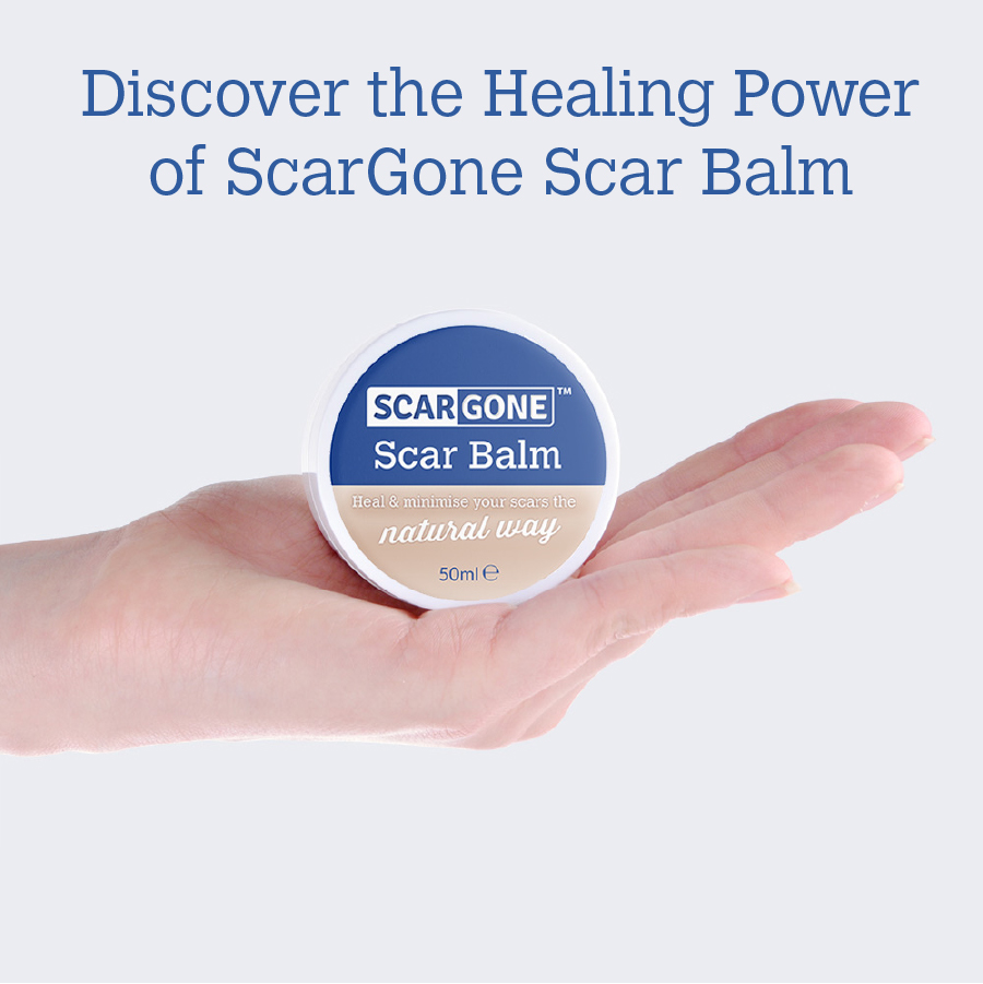 ScarGone Scar Balm