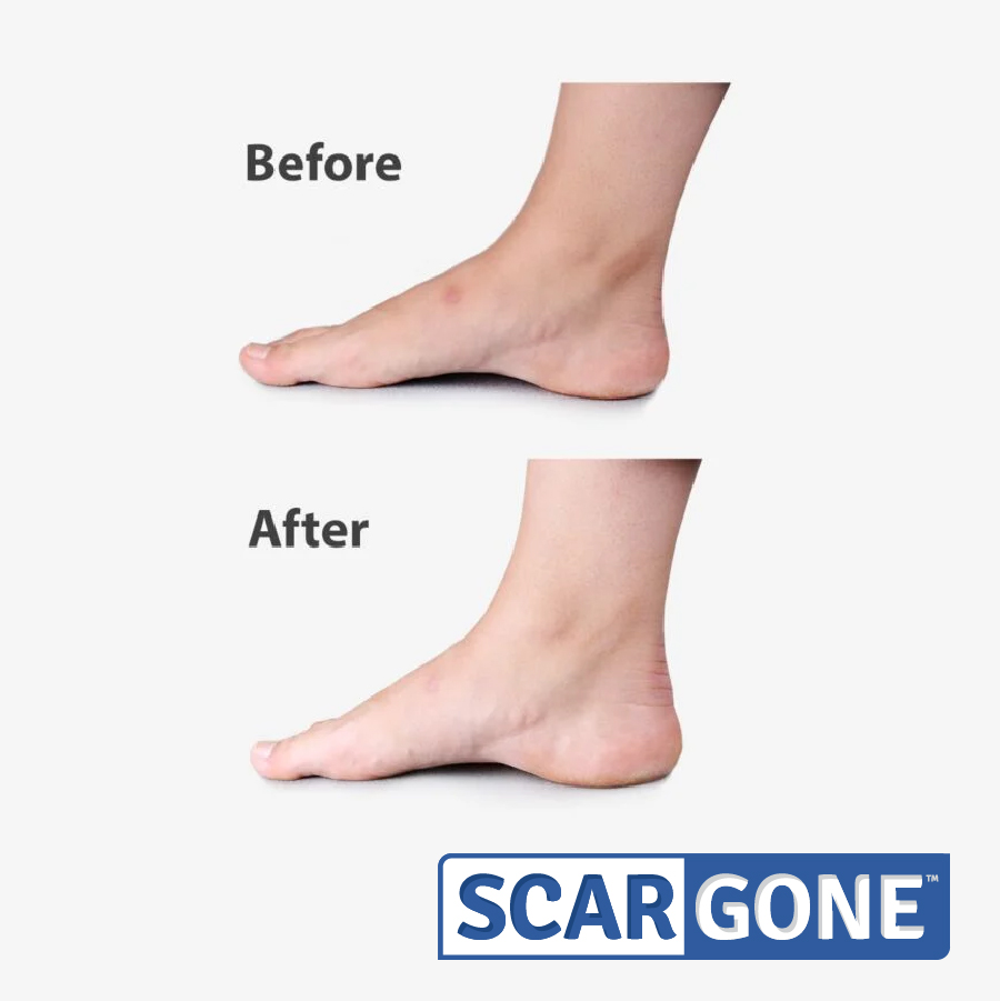 ScarGone Scar Balm