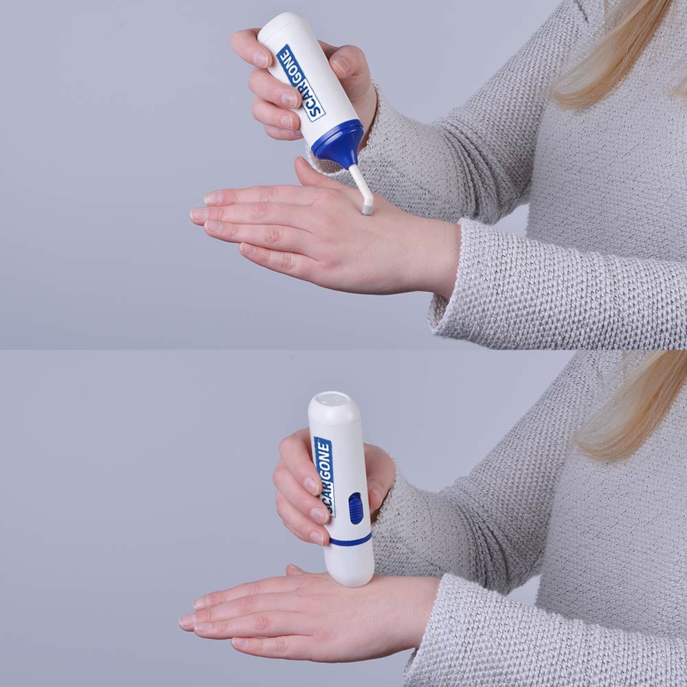 ScarGone™ Scar Management Massager & Balm Set 