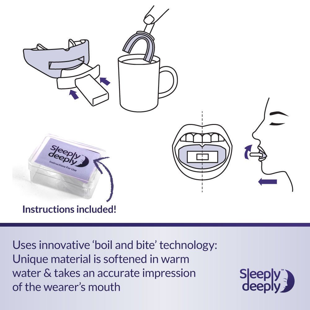 Sleeply Deeply anti-snoring mouth guard using boil-and-bite technology. Softens in warm water to mould to your teeth for a custom fit, advancing the lower jaw to keep the airway open and reduce snoring for better sleep.