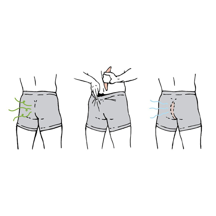 Illustration showing how the Carbonana flatulence-filtering cushion is worn inside underwear, demonstrating odour release, correct placement between the buttocks, and filtered airflow for discreet flatulence control.