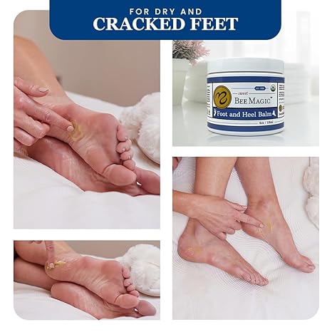 Sweet Bee Magic: Foot and Heel Balm