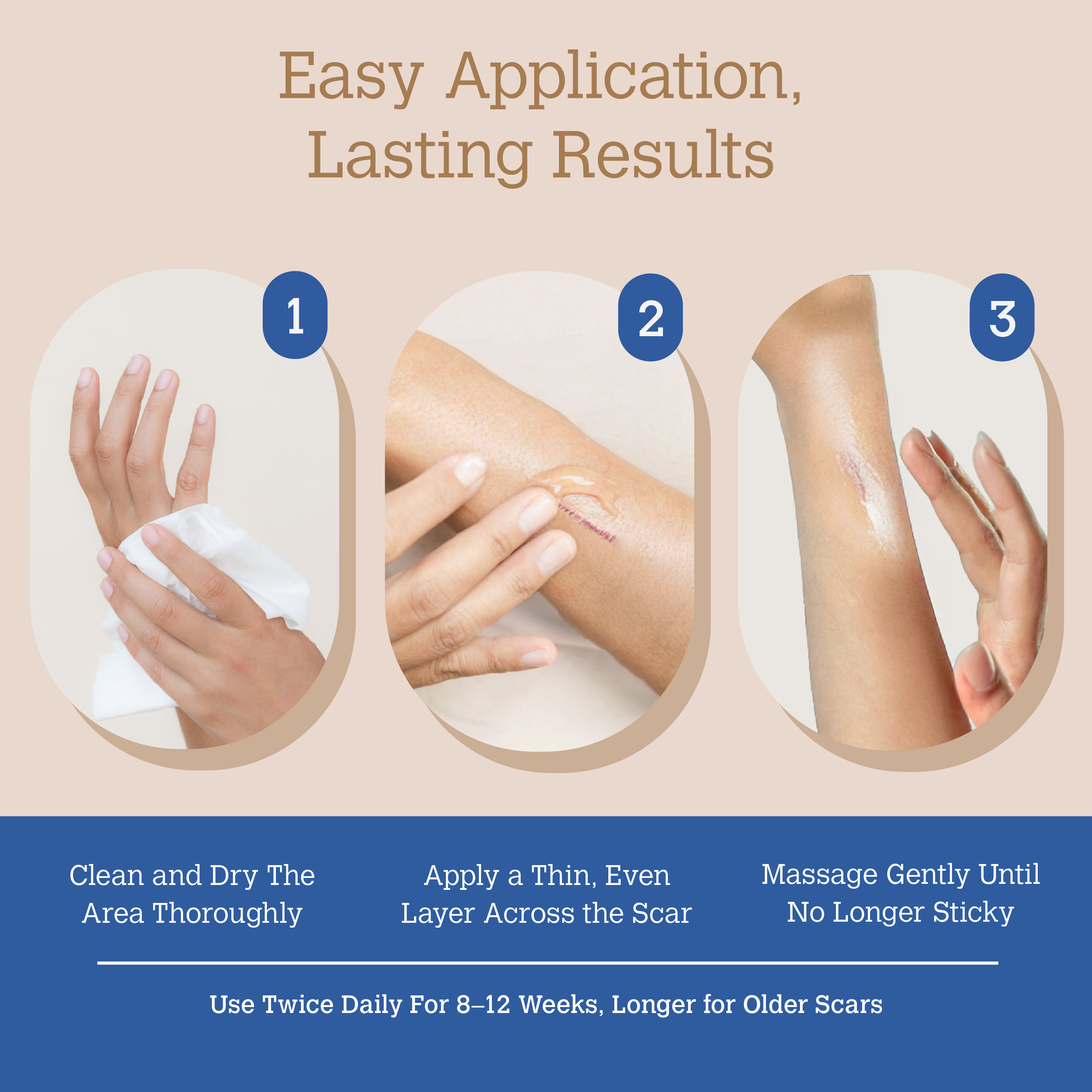 ScarGone Silicone Scar Gel