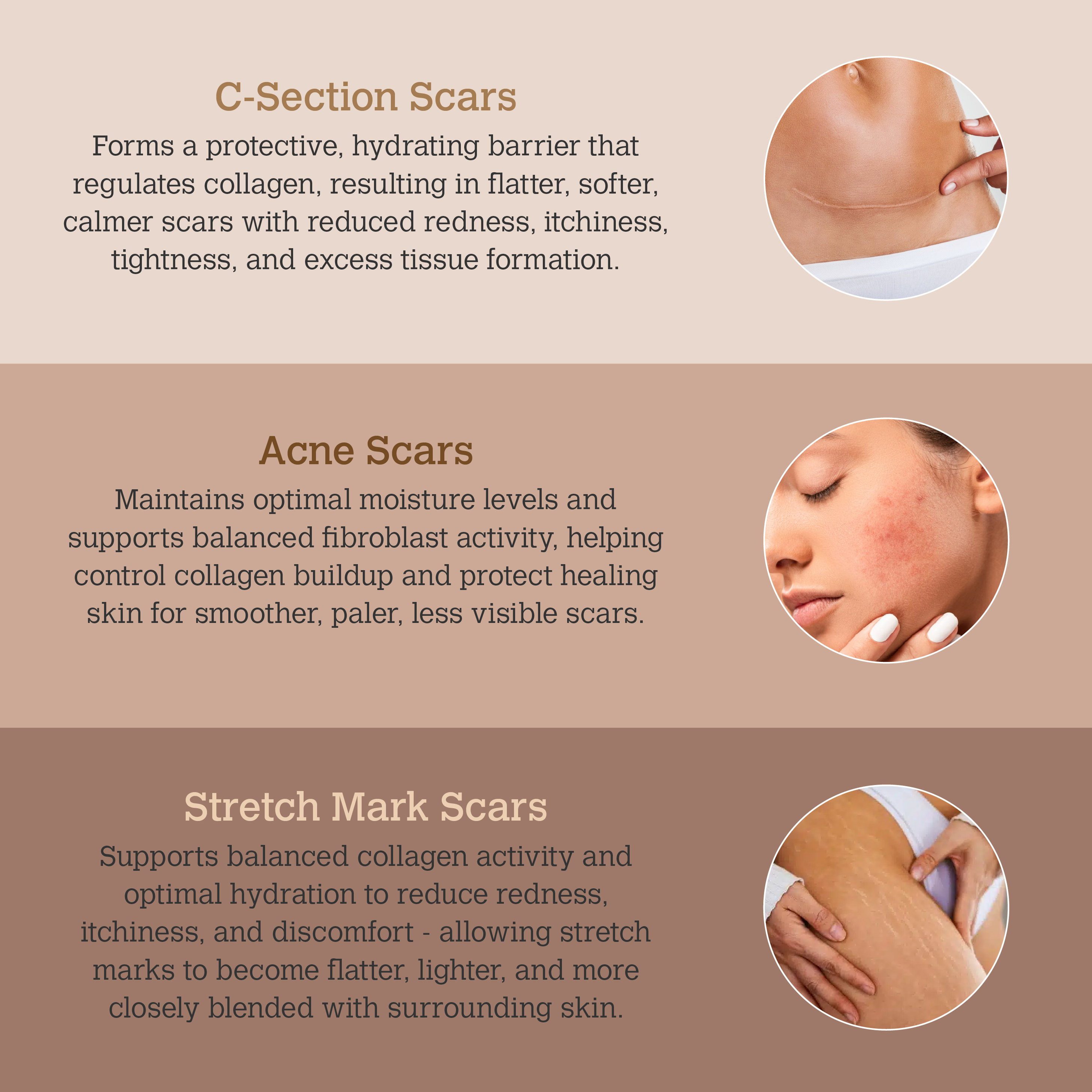 ScarGone Silicone Scar Therapy Sheets