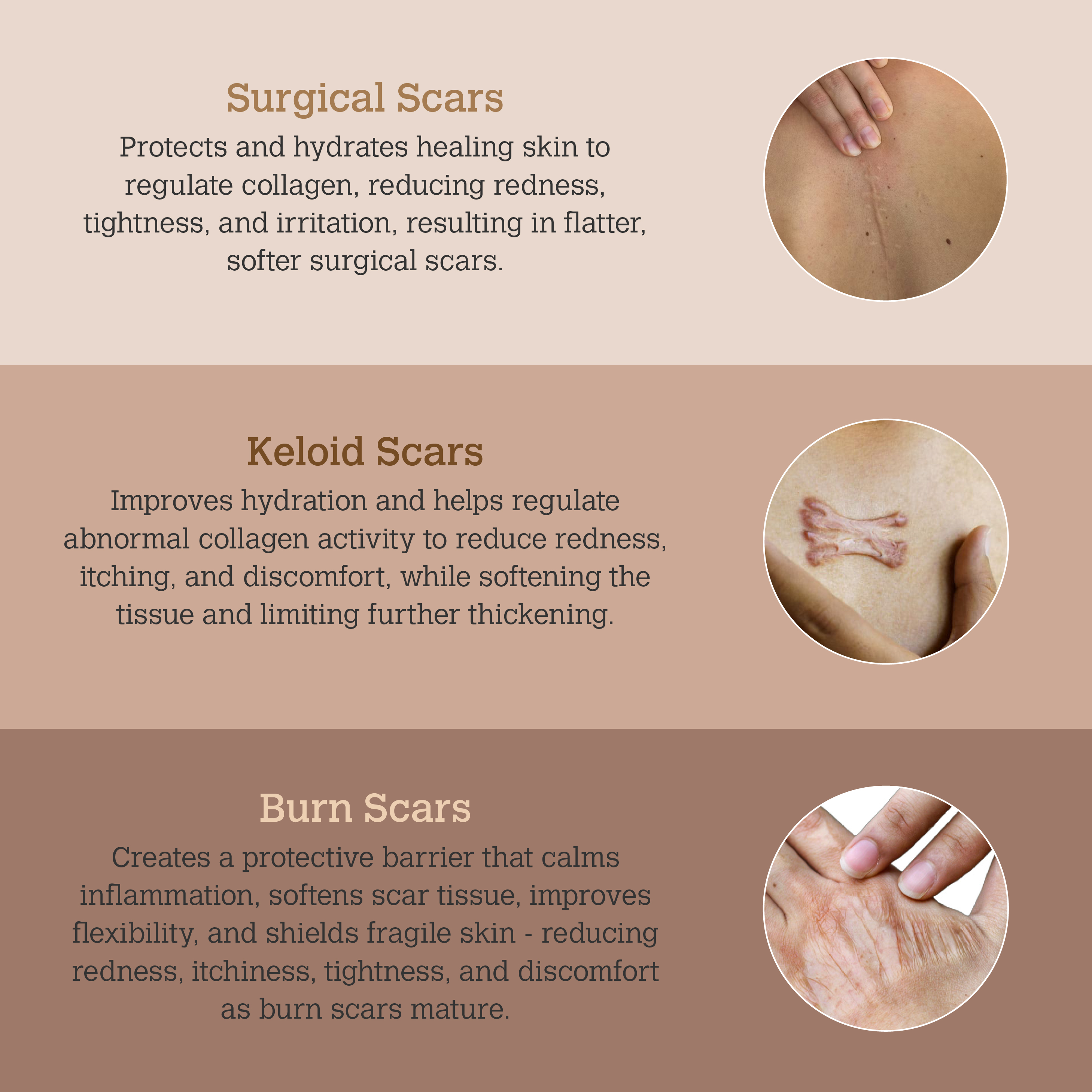 ScarGone Silicone Scar Therapy Sheets
