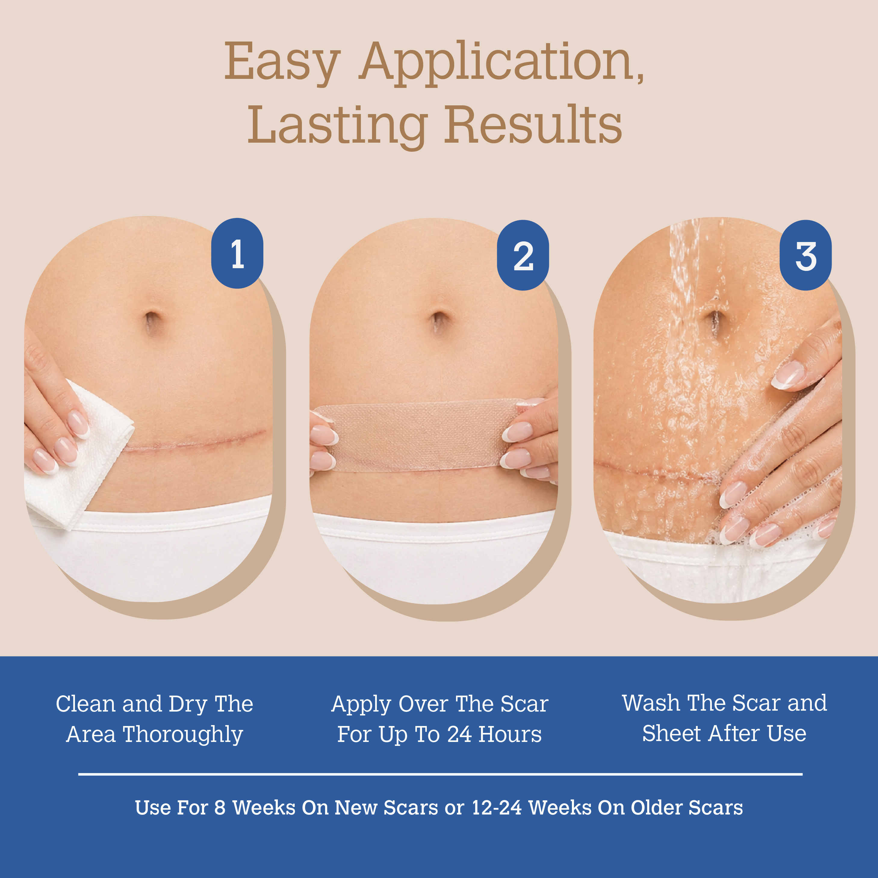 ScarGone Silicone Scar Therapy Sheets