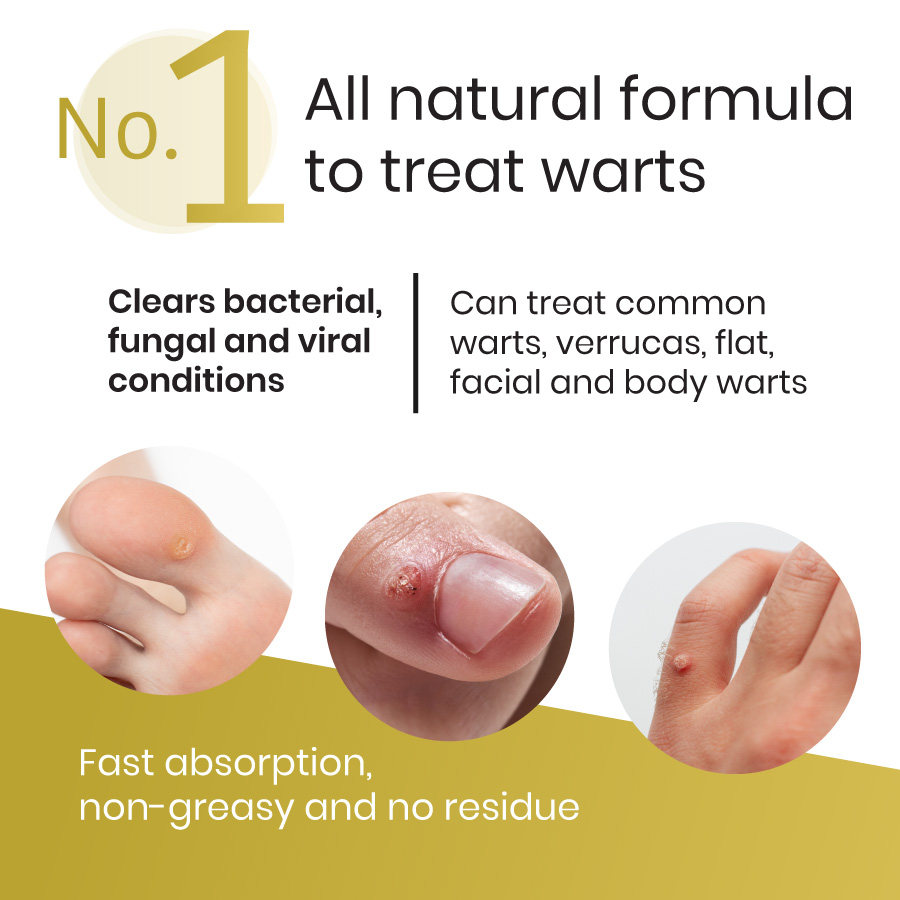 Natural Healing Oils No.1 Warts