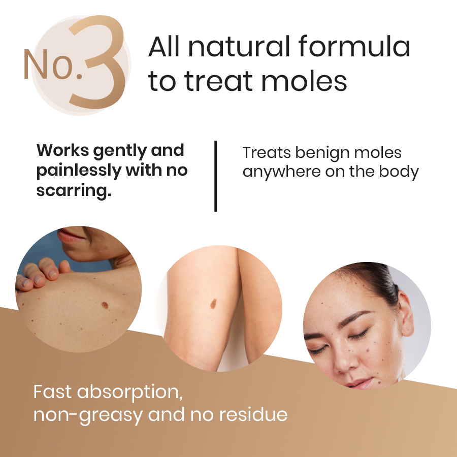 Natural Healing Oils No.3 Moles