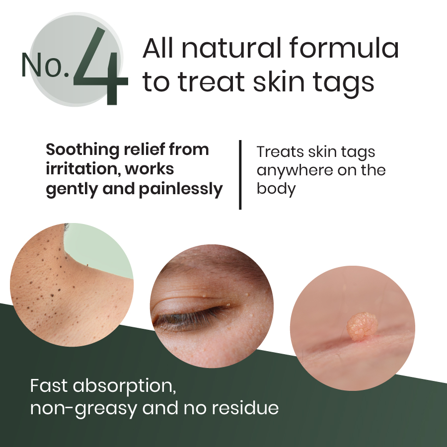 Natural Healing Oils No.4 Skin Tags
