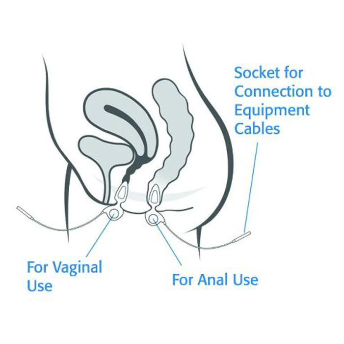 Kegel8 Target Probe 5