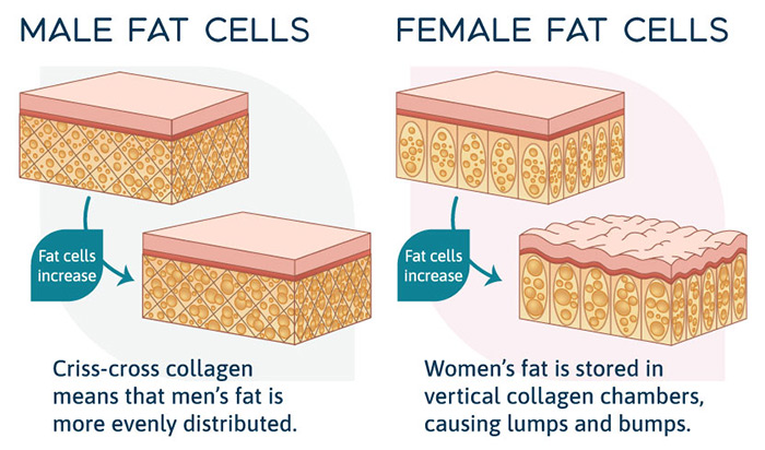 How Fat Is Stored In Men & Women