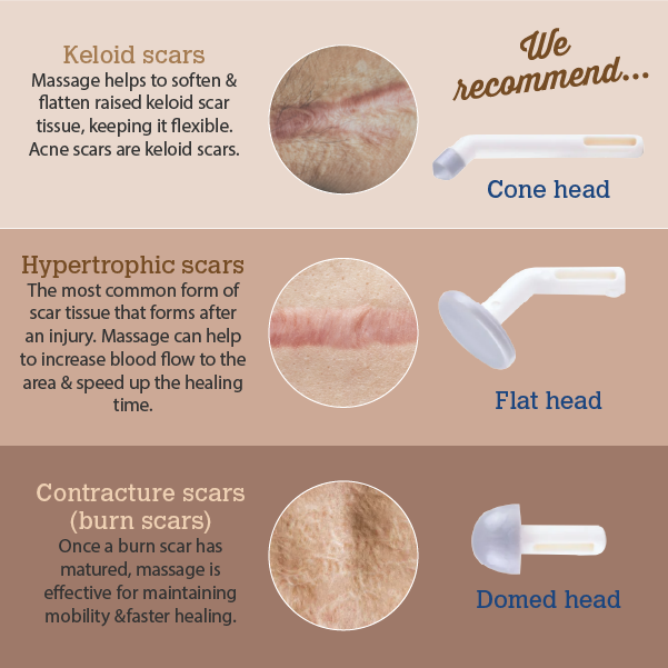 Educational ScarGone graphic explaining different scar types including keloid scars, hypertrophic scars and contracture burn scars, with recommended massage heads such as cone head, flat head and domed head for targeted scar massage