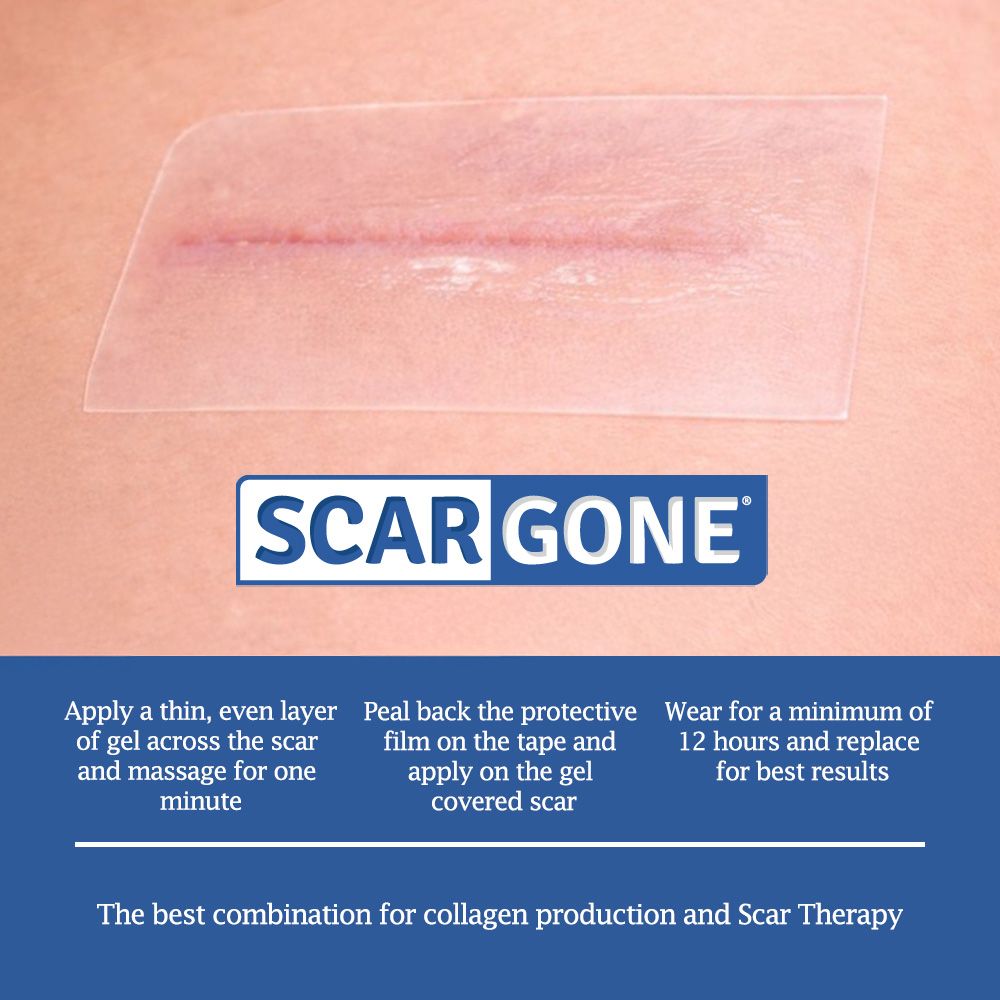 ScarGone Complete Silicone Scar Therapy Pack