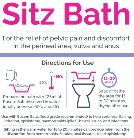 Kegel8 Sitz Bath instructions graphic explaining relief for pelvic and perineal discomfort, with directions to dissolve 125 ml of Epsom salts in warm water at 50 to 55 degrees Celsius and soak the area for 15 to 20 minutes