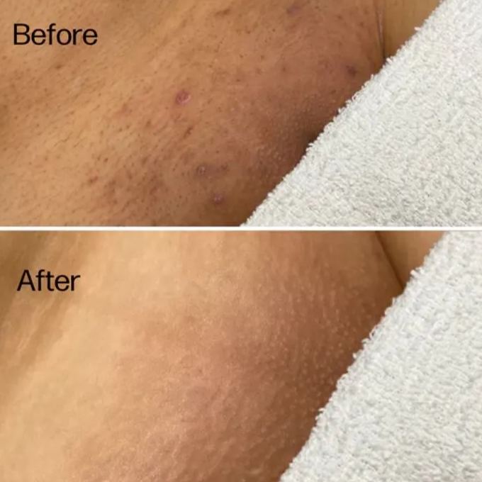 Medicine Mama's Grooming Polish  Smooth & Clear Bikini Line