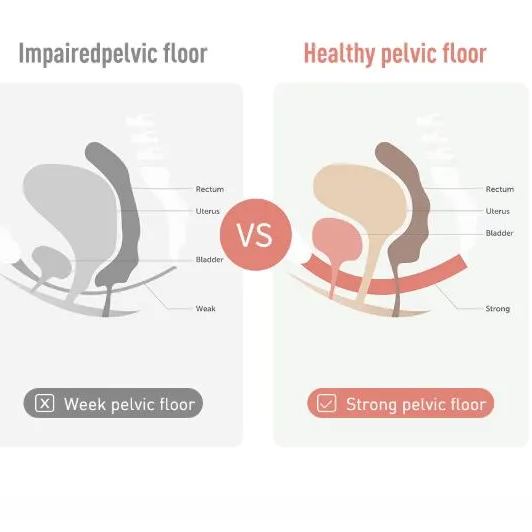 Kegelflex Vaginal Cones With Adjustable Weights