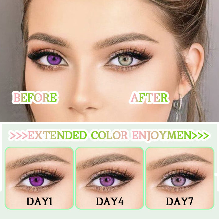 Anustur™ Οφθαλμικές σταγόνες HueShift