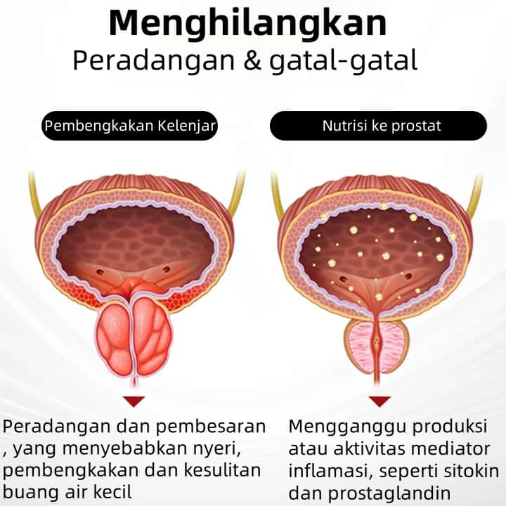 Αναπνεύστε ήρεμα και βελτιώστε την υγεία του προστάτη σας! Το ρινικό σπρέι Lovilds™ ProstaAir βελτιώνει τη ροή του αίματος και μειώνει τη φλεγμονή με φυσικό τρόπο χάρη σε ένα ισχυρό εκχύλισμα βοοειδών. 💪
