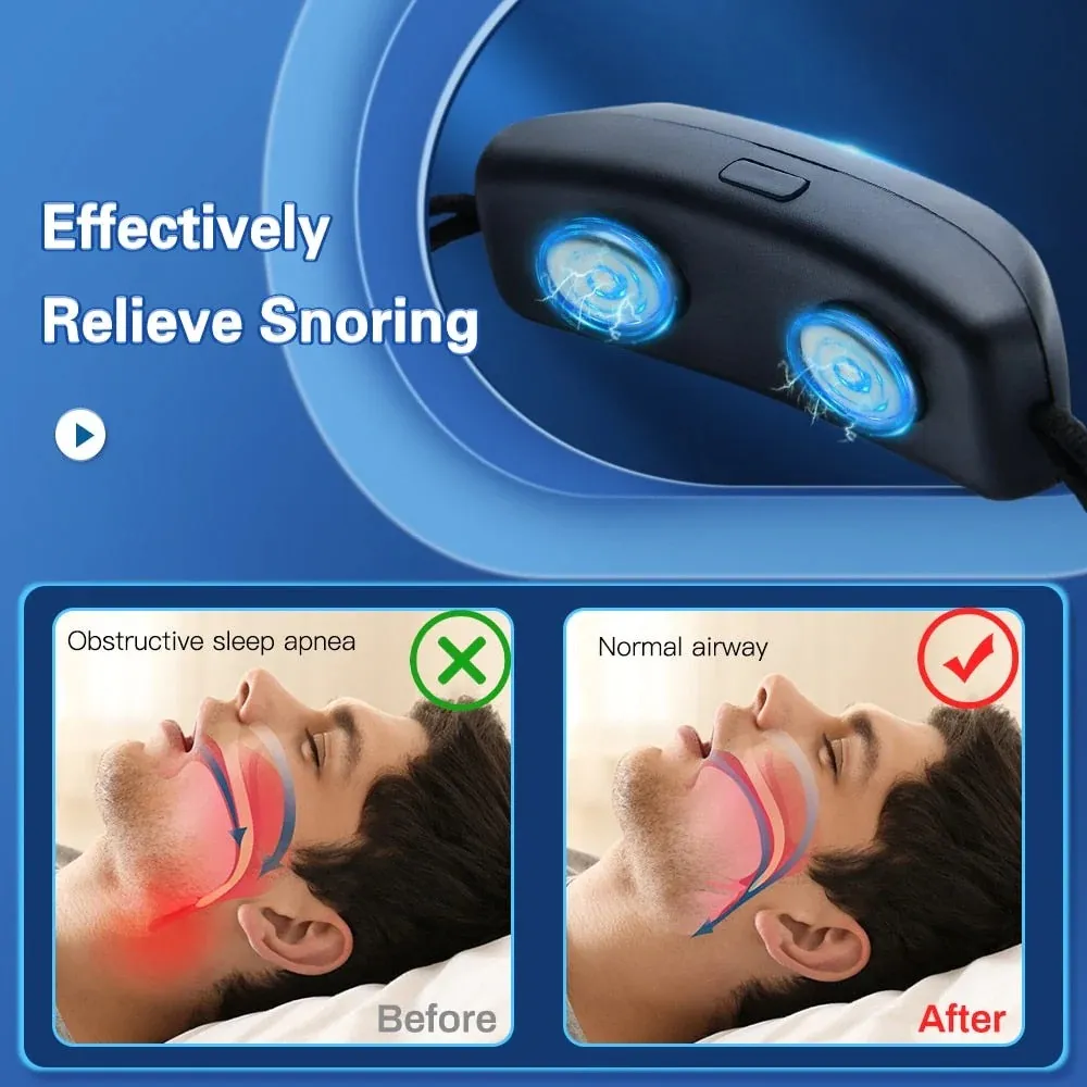 🔥🔥The latest product in 2023🛌smart anti-snoring device