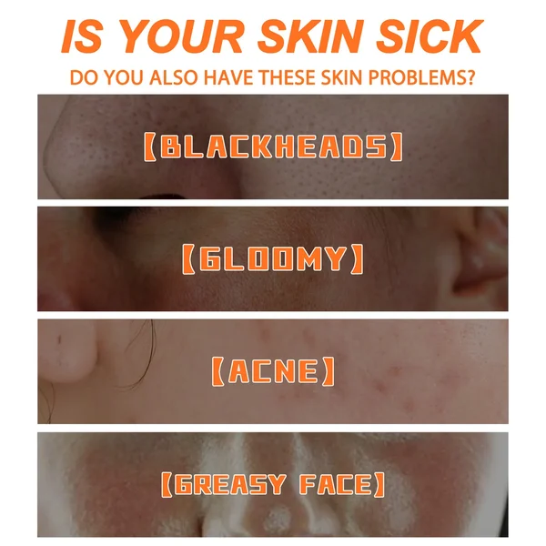 🔥 Hot Sale-49% OFF💥 2023 New Magical Carrot Bubble Mask - BUY 2 GET1 FREE