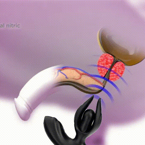 Prostate Care GIF