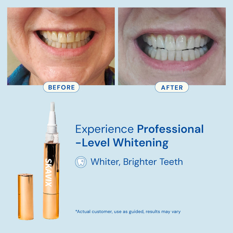 Extra-Strength Teeth Whitening Serum Pen + Dual-Peroxide Formula & Xylitol