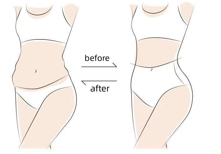 🔥 [3db 12800 Ft] Ionos nadrág a laminálási eljárással történő testformáláshoz