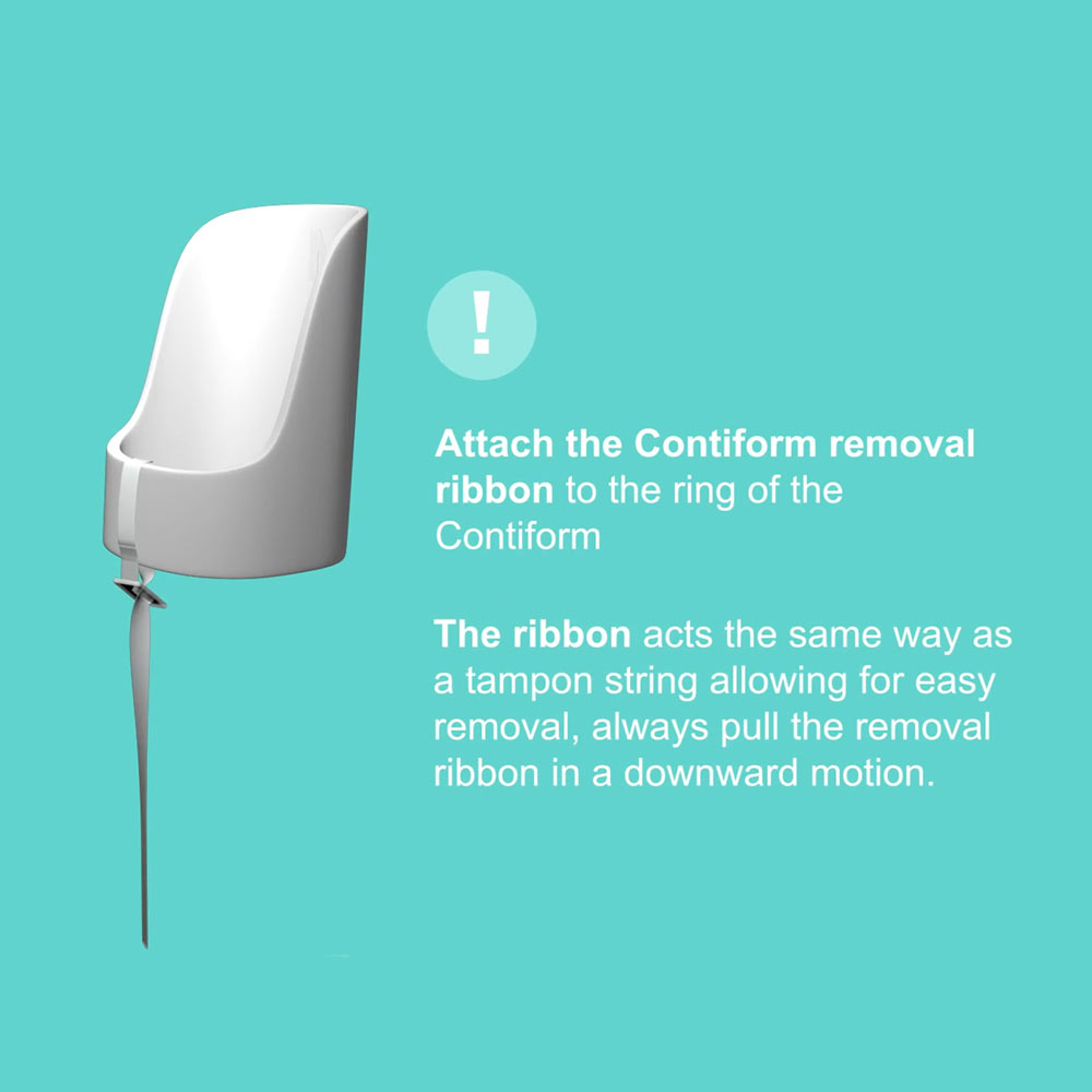 Contiform Vaginal Pessary / New User Kit