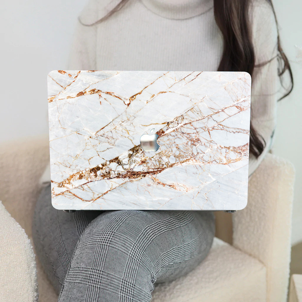 Golden shock Macbook Case-BELKCASE