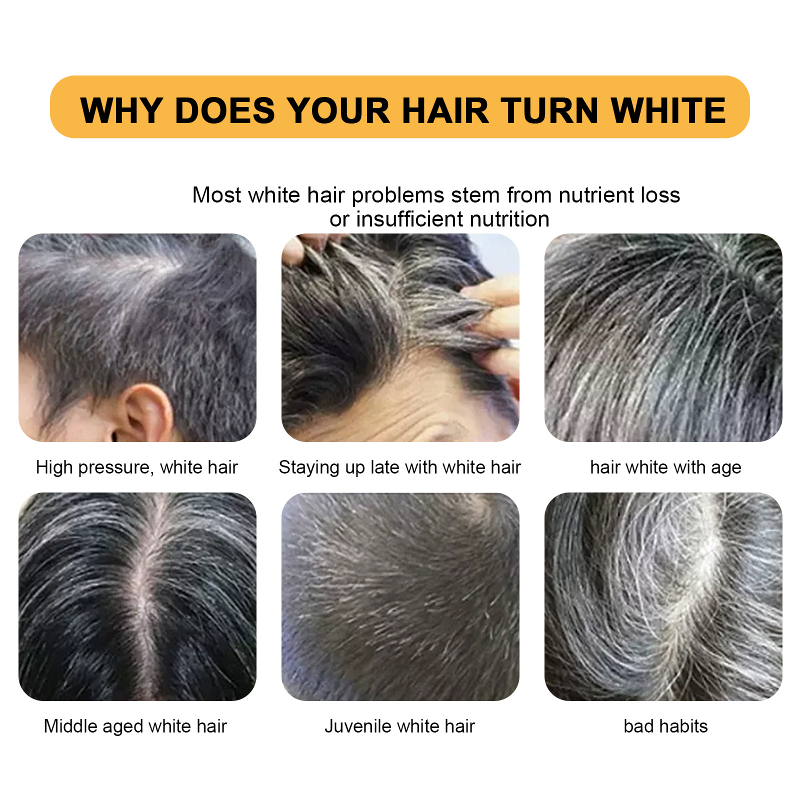 🔥Last Day 70% OFF-Sundaz Pure Gray Hair Reverse Bar-FREE SHIPPING