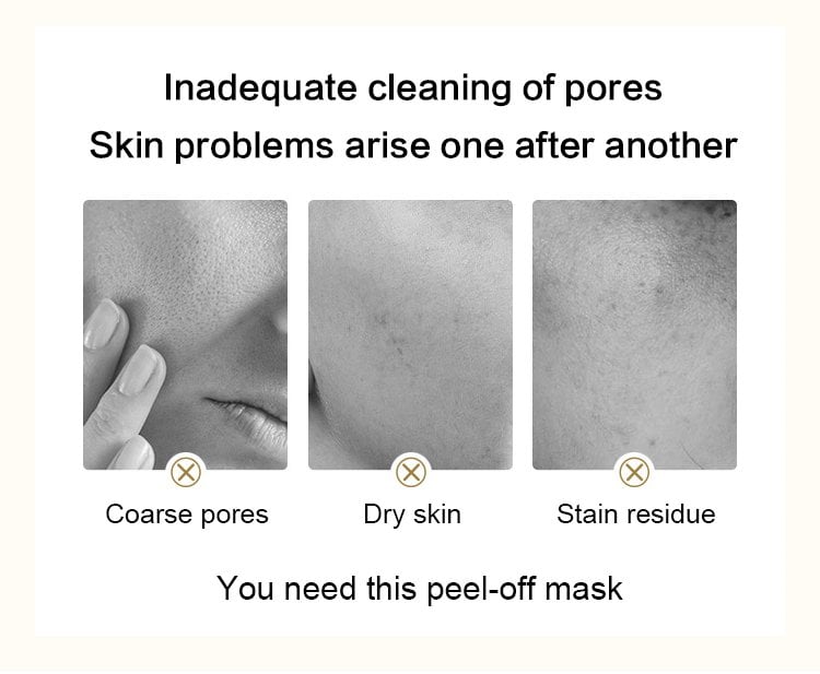 🔥HOT SALE 50% OFF-Retinol snake venom gold mask