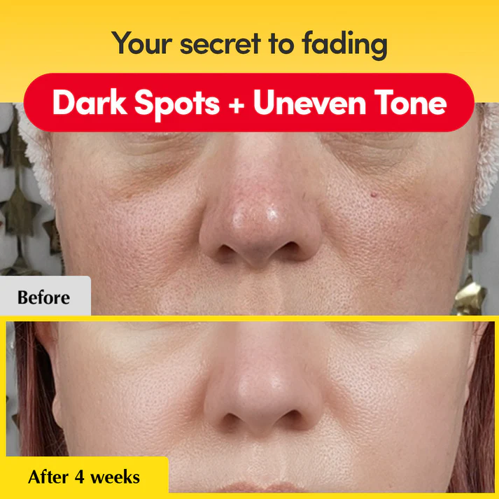 Vitamin Illuminating Serum | Niacinamide 4% + Brightening Vitamin C Face Serum with Hyaluronic Acid & Vitamin E | Dark Spot, Uneven Tone Care | Korean Skincare