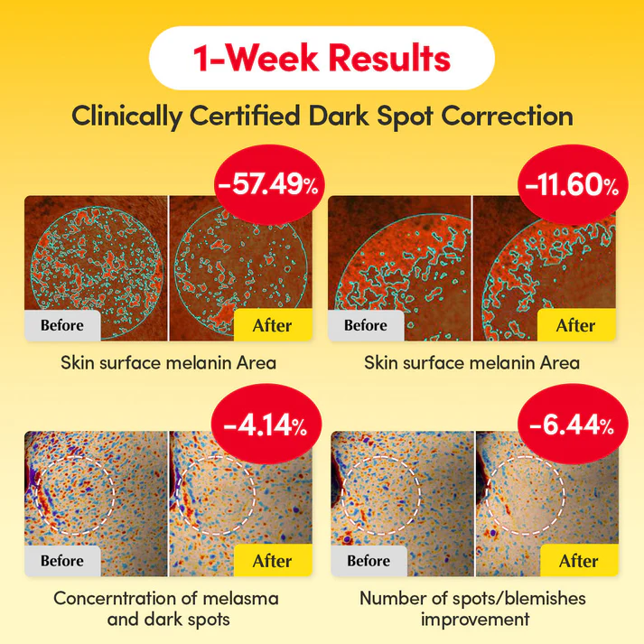 Vitamin Illuminating Serum | Niacinamide 4% + Brightening Vitamin C Face Serum with Hyaluronic Acid & Vitamin E | Dark Spot, Uneven Tone Care | Korean Skincare