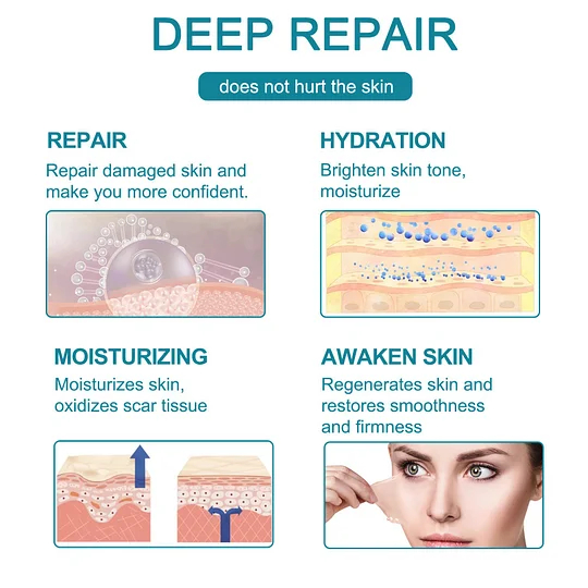 ❤️ScarRemoveTM Advanced Scar Spray For All Types of Scars - For example Acne Scars, Surgical Scars and Stretch Marks ⚡️⚡️⚡️