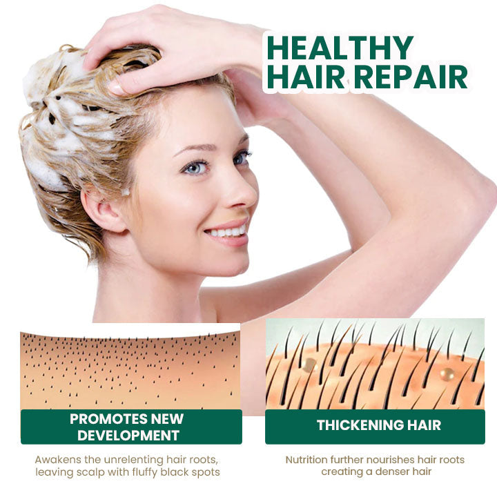 Oveallgo™ Glamor Ginger Essential Hair Growth Cream