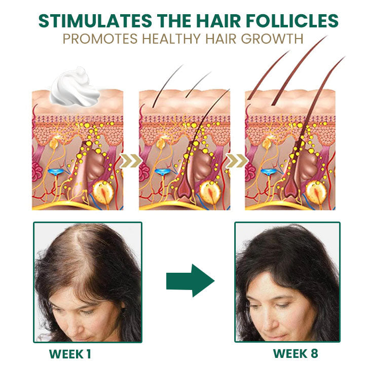 Oveallgo™ Glamor Ginger Essential Hair Growth Cream