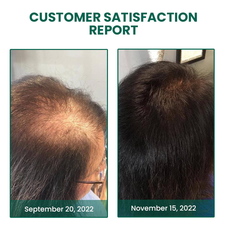 Oveallgo™ Glamor Ginger Essential Hair Growth Cream